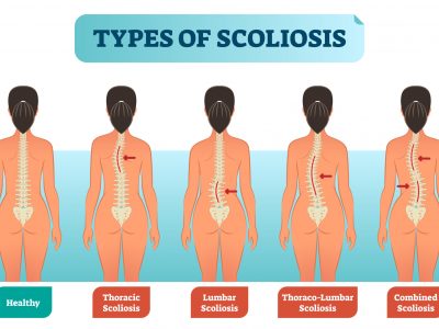 shutterstock_1082209535 (1)