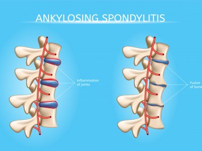 shutterstock_1130483519 (1)