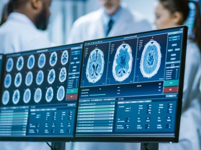 Computer,Screen,Showing,Mri,,Ct,Image,Scan,Of,The,Brain.