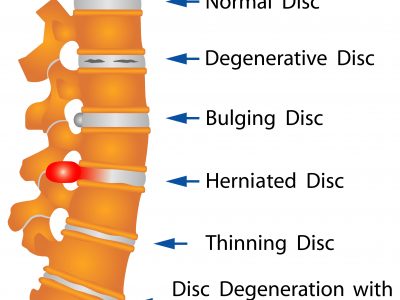 shutterstock_152531303 (1)