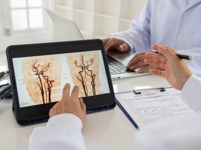 Doctor,Team,Diagnose,Brain,Stroke,And,Blood,Vessels,X-ray,Image