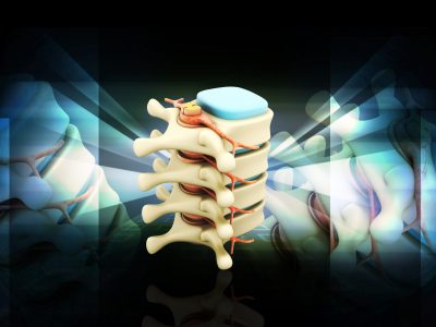 Digital,Illustration,Of,Spinal,Column,With,Nerves,And,Discs,In